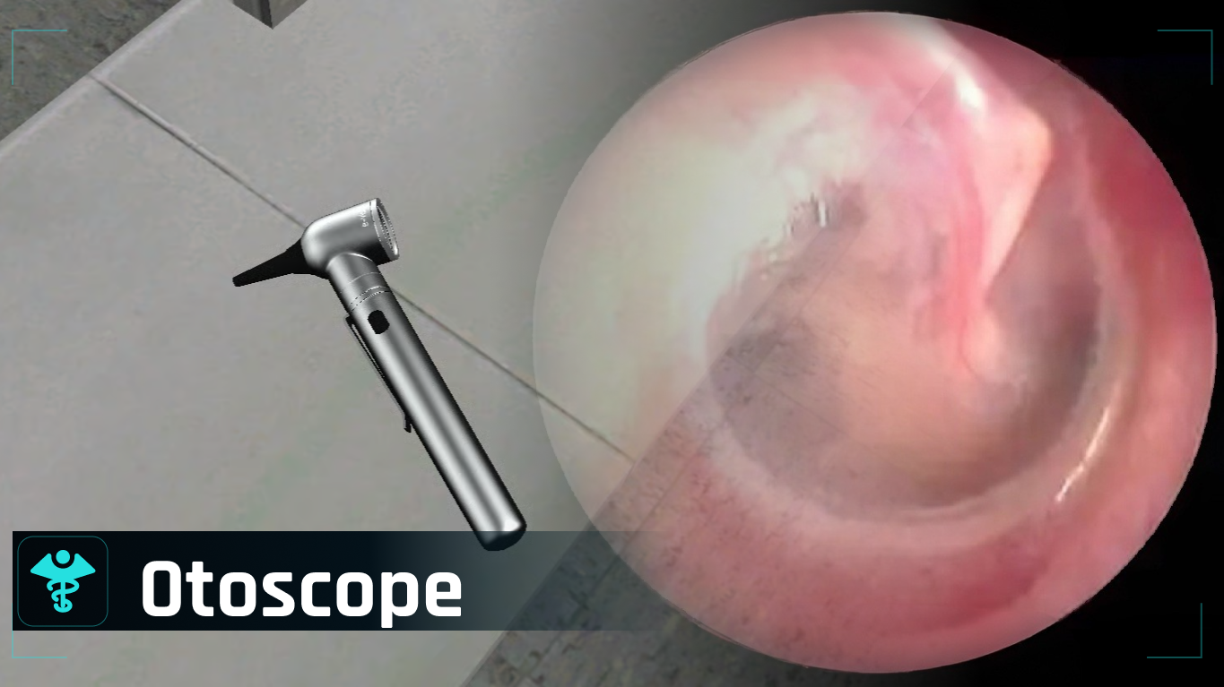 Otoscope/Diagnosis