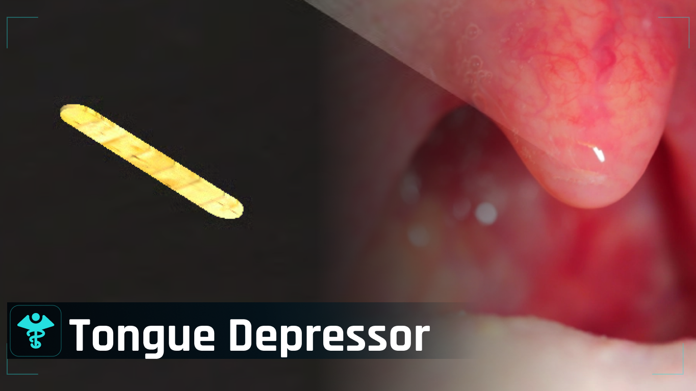 Tongue depressor/Diagnosis